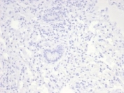Negative: IHC staining of FFPE horse lung tissue with Nucleolin antibody (clone NCL/7014R). HIER: boil tissue sections in pH 9 10mM Tris with 1mM EDTA for 20 min and allow to cool before testing.