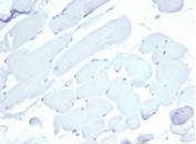 Negative: IHC staining of FFPE cow heart tissue with Nucleolin antibody (clone NCL/7014R). HIER: boil tissue sections in pH 9 10mM Tris with 1mM EDTA for 20 min and allow to cool before testing.