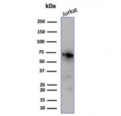 Western blot testing of human Jurkat cell lysate with Nucleolin antibody (clone NCL/7014R). Predicted molecular weight ~77 kDa, can be observed at 100~110 kDa.