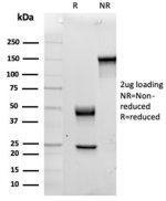 IL15 Antibody IL15/4354 Purity and Integrity by SDS-PAGE. SDS-PAGE analysis of 2 ug purified IL15 Antibody (clone IL15/4354) shows distinct immunoglobulin heavy and light chains at approximately 45-50 kDa and 22-25 kDa, respectively, under reducing conditions. Under non-reducing conditions, the intact antibody migrates as a prominent band at approximately 140-150 kDa. The expected migration patterns under reducing and non-reducing conditions support the integrity and purity of this Interleukin-15 Monoclonal Antibody preparation.
