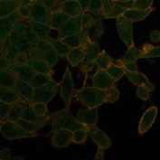 UBR2 Antibody HeLa Cell IF. Immunofluorescent staining of PFA-fixed human HeLa cells using clone PCRP-UBR2-1D12 (green) and phalloidin cytoskeletal counterstain (red). Ubiquitin protein ligase E3 component n-recognin 2 / UBR2 displays predominantly cytoplasmic and perinuclear staining with additional punctate intracellular signal, consistent with its role in ubiquitin-mediated protein turnover and N-end rule pathway regulation associated with cellular proteostasis mechanisms.