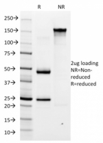 SDS-PAGE analysis of purified, BSA-free Helicobacter pylori antibody (clone HP/1334) as confirmation of integrity and purity.