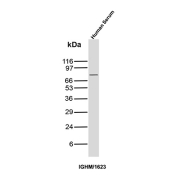 Western blot analysis of IgM heavy chain in human serum. Human serum lysate was separated by SDS-PAGE under reducing conditions and probed with IgM Heavy Chain antibody (clone IGHM/1623). A distinct band is detected at approximately 70 kDa, consistent with the predicted molecular weight of the immunoglobulin mu heavy chain based on its amino acid sequence.