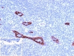 von Willebrand Factor Antibody / Weibel-Palade Body Marker Antibody. Immunohistochemistry analysis of human tonsil tissue shows HRP-DAB brown staining of endothelial cells lining vascular channels, with intracellular signal reflecting VWF localization within Weibel-Palade bodies. The staining appears as granular and focal cytoplasmic deposition along vessel linings, consistent with endothelial storage organelles within these cells. This pattern highlights both vascular structures and the subcellular distribution of VWF within endothelial compartments. Clone VWF/4106 enables visualization of vessel-associated endothelium with organelle-level detail. Negative control inset shows absence of staining when PBS is used instead of primary antibody, confirming specificity of the detected signal. HIER: boil tissue sections in pH 9 10mM Tris with 1mM EDTA for 20 min and allow to cool before testing.