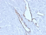 von Willebrand Factor Antibody / Weibel-Palade Body Marker Antibody. Immunohistochemistry analysis of human pancreatic tissue shows HRP-DAB brown staining of endothelial cells lining vascular channels, with signal localized to the cytoplasm in a granular pattern consistent with VWF-containing Weibel-Palade bodies. The staining outlines elongated vessel structures within the pancreatic stroma, while intracellular deposition highlights endothelial storage organelles along the vessel lining. Clone VWF/4106 enables visualization of both vascular architecture and subcellular VWF localization within endothelial compartments. HIER: boil tissue sections in pH 9 10mM Tris with 1mM EDTA for 20 min and allow to cool before testing.