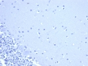CD44 Antibody Brain IHC Negative Control: IHC staining of FFPE human brain tissue using CD44 antibody (clone rHCAM/6449) at 2ug/ml in PBS for 30min RT. HIER: boil tissue sections in pH 9 10mM Tris with 1mM EDTA for 20 min and allow to cool before testing.