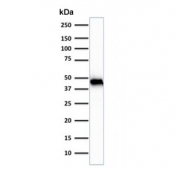 Western blot testing of human skeletal muscle tissue lysate using Muscle Actin antibody (clone rMSA/953). Predicted molecular weight ~45 kDa.