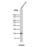 Haptoglobin Antibody HP/3835 Detection in Human Liver WB. Western blot analysis of human liver tissue lysate using Haptoglobin Antibody clone HP/3835. A strong, discrete band is detected at approximately 24 kDa. Haptoglobin is synthesized as an approximately 45 kDa precursor that undergoes proteolytic processing into alpha and beta chains; glycosylation of the processed protein can influence its apparent molecular weight on SDS-PAGE.