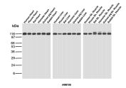 Recombinant Nuclear Antigen Antibody for WB Multi-Species Western Blot. Western blot analysis of heart, liver, and skeletal muscle tissue lysates from human, mouse, rat, hamster, guinea pig, and rabbit using Recombinant Nuclear Antigen Antibody for WB / Western Blot Validated Antibody (clone rNM106) demonstrates a strong immunoreactive band at approximately 110-116 kDa across all tested tissues and species. The highly consistent banding pattern indicates broad cross-species reactivity and recognition of a conserved nuclear-associated antigen expressed in diverse mammalian cell types. Robust signal is observed in cardiac, hepatic, and skeletal muscle samples from each species tested, supporting reliable detection of the target antigen in multiple biological systems. Because the recognized nuclear antigen is widely expressed and highly conserved, clone rNM106 serves as a valuable reagent for comparative biology studies, translational research, species cross-reactivity assessment, and western blot applications requiring broad mammalian reactivity. The observed molecular weight remains consistent across all tested samples and demonstrates the utility of this recombinant antibody for detection of nuclear-associated proteins in mammalian tissue lysates. Observed molecular weight: ~110-116 kDa.