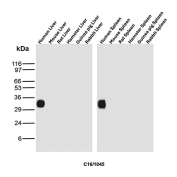 CD16 Antibody Immune Tissue WB. Western blot analysis of human liver, mouse liver, rat liver, hamster liver, guinea pig liver, rabbit liver, human spleen, mouse spleen, rat spleen, hamster spleen, guinea pig spleen, and rabbit spleen tissue lysates using CD16 antibody clone C16/1045. A distinct immunoreactive band is detected in human liver and human spleen samples near the expected molecular weight range of FCGR3 / CD16, consistent with expression of this Fc gamma receptor in immune-associated tissues involved in leukocyte activation and Fc-mediated innate immune signaling pathways.