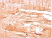DMD Antibody Skeletal Muscle Tissue IHC. Immunohistochemistry analysis of FFPE human skeletal muscle tissue using DMD Antibody (clone DMD/3676) shows membranous staining along muscle fibers, consistent with detection of Dystrophin / DMD at the sarcolemma. The staining outlines muscle fiber architecture with moderate intensity, while surrounding connective tissue displays minimal background signal. Hematoxylin counterstain provides nuclear contrast and tissue morphology. HIER: boil FFPE tissue sections in pH 9 10 mM Tris with 1 mM EDTA for 20 min and allow to cool before testing.