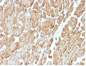 DMD Antibody Cardiac Muscle IHC. Immunohistochemistry analysis of FFPE human heart muscle tissue using DMD Antibody (clone DMD/3676) shows membranous staining outlining cardiomyocytes, consistent with detection of Dystrophin / DMD at the sarcolemma. The staining highlights cardiac muscle fiber architecture with moderate intensity, while interstitial regions display minimal background signal. Hematoxylin counterstain provides nuclear contrast and tissue morphology. HIER: boil FFPE tissue sections in pH 9 10 mM Tris with 1 mM EDTA for 20 min and allow to cool before testing.