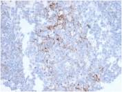 CD23 Antibody Colon Immunohistochemistry. IHC staining of FFPE human colon tissue with CD23 antibody (clone FCER2/6890) at 2ug/ml in PBS for 30min RT. HIER: boil tissue sections in pH 9 10mM Tris with 1mM EDTA for 20 min and allow to cool before testing.