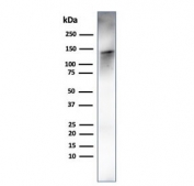 Caldesmon Antibody / CALD1 Cellular Mechanical Stress Response Protein Antibody. Western blot analysis of Caldesmon (CALD1) in human ovary tissue lysate. Lane 1: human ovary tissue lysate. A band is detected at approximately 120-150 kDa, consistent with the predicted molecular weight of Caldesmon / CALD1 and representing the high molecular weight h-caldesmon isoform associated with mechanically resilient contractile cells. Additional lower molecular weight bands may be observed at approximately 70-80 kDa corresponding to non-muscle isoforms involved in cytoskeletal adaptation to mechanical stress. The observed banding pattern reflects isoform-dependent expression of CALD1 linked to cellular mechanical stress response and cytoskeletal stability.