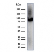 CD36 Antibody Heart WB. Western blot analysis of human heart tissue lysate demonstrates CD36 expression using CD36 antibody clone CD36/7217. CD36, also known as Fatty Acid Translocase, is a multifunctional scavenger receptor that mediates long chain fatty acid uptake and plays a critical role in cardiac energy metabolism. A prominent band is detected at approximately 90 kDa, consistent with the extensively glycosylated form of CD36. The apparent molecular weight of CD36 is known to vary from approximately 53 to 88 kDa depending on the degree of glycosylation. These results support the utility of CD36 Antibody for studies of lipid transport, cardiovascular biology, and metabolic regulation.