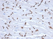 N-Cadherin Antibody Human Heart IHC. Immunohistochemistry staining of intercalated discs in FFPE human heart tissue with recombinant N-Cadherin antibody (clone CDH2/6857R). HIER: boil tissue sections in pH 9 10mM Tris with 1mM EDTA for 20 min and allow to cool before testing.