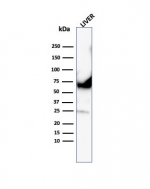 Western blot testing of human liver lysates using recombinant Albumin antibody (clone ALB/6413R). Predicted molecular weight ~69 kDa.