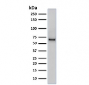 SOX9 Antibody Human PC-3 Cancer Cell WB. Western blot analysis of human PC-3 prostate cancer cell lysate using SOX9 Antibody. Recombinant monoclonal antibody clone SOX9/2387 detects a distinct band at approximately 56-65 kDa, consistent with the predicted molecular weight of SOX9. SOX9 is a nuclear transcription factor associated with cancer stem cell regulation and differentiation, and expression in PC-3 cells aligns with its role in tumor progression. Minor variation in apparent molecular weight may reflect post-translational modifications or protein processing.