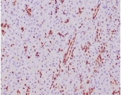 IHC staining of FFPE human pancreatic tissue with SOX9 antibody (clone SOX9/2387) at 2ug/ml. HIER: boil tissue sections in pH 9 10mM Tris with 1mM EDTA for 20 min and allow to cool before testing.
