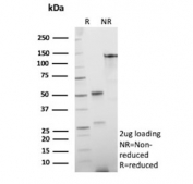 SDS-PAGE analysis of purified, BSA-free recombinant EpCAM antibody (clone rEGP40/826) as confirmation of integrity and purity.