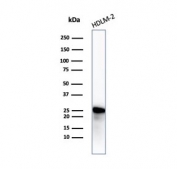 Western blot testing of human HDLM-2 cell lysate with recombinant Bcl-2 antibody. Predicted molecular weight ~26 kDa.
