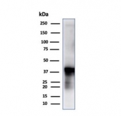 Western blot testing of human liver tissue using monoclonal GLUL antibody (clone GLUL/6604). Predicted molecular weight ~42 kDa.
