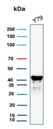 GLUL Antibody Y79 WB. Western blot analysis of Y79 cell lysate using GLUL Antibody mouse monoclonal clone GLUL/6604. A strong band is detected at approximately 42-45 kDa, consistent with the predicted molecular weight of Glutamate-ammonia ligase / GLUL, a glutamine-synthesizing enzyme involved in nitrogen metabolism and regulation of glutamate homeostasis. Faint lower molecular weight bands beneath the primary signal likely represent minor degradation products or partially processed GLUL species commonly observed in cell lysates.