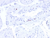CSTF2T Antibody Human Testis IHC. Immunohistochemistry analysis of FFPE human testis tissue stained with clone PCRP-CSTF2T-1A3. Scattered germ cell populations within seminiferous tubules display distinct nuclear HRP-DAB brown staining, aligning with the known testis-enriched expression profile of Cleavage stimulation factor subunit 2 tau / CSTF2T and its involvement in germ cell differentiation and spermatogenesis-associated RNA processing. Interstitial stromal cells show minimal background signal. HIER: boil tissue sections in pH 9 10mM Tris with 1mM EDTA for 20 min and allow to cool before testing.