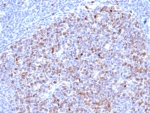 Topoisomerase II alpha Antibody / Cell Cycle Regulator Antibody (clone rTOP2A/6629). Immunohistochemistry analysis of FFPE human tonsil tissue shows strong nuclear staining of DNA Topoisomerase II alpha in proliferating lymphoid cells. Nuclear immunoreactivity is most prominent within germinal center lymphocytes, consistent with elevated expression of this cell cycle regulator in actively dividing immune cells. As a Cell Cycle Regulator Antibody, clone rTOP2A/6629 highlights lymphocyte populations undergoing active cell cycle progression where TOP2A activity supports chromosome organization and mitotic preparation. HIER: boil tissue sections in pH 9 Tris-EDTA buffer for 20 min followed by cooling at RT prior to immunohistochemistry staining.