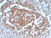 Immunohistochemistry analysis of CD40 Antibody Recombinant Rabbit MAb in human tonsil tissue. FFPE human tonsil shows strong membranous and cytoplasmic HRP-DAB brown staining in lymphoid cells within germinal centers and interfollicular regions, consistent with CD40 expression in B lymphocytes and antigen-presenting cells. Clone C40/4826R was used following heat-induced epitope retrieval by boiling tissue sections in pH 9 10 mM Tris with 1 mM EDTA for 20 minutes and cooling prior to staining.