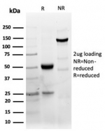 SDS-PAGE analysis of purified, BSA-free CD40 antibody (clone C40/4826R) as confirmation of integrity and purity.