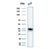 Western blot testing of human Raji cell lysate with CD40 antibody. Expected molecular weight is 30-45 kDa depending on glycosylation level.