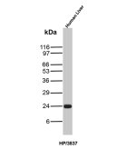 Haptoglobin Antibody HP/3837 Detection in Human Liver WB. Western blot analysis of human liver tissue lysate using Haptoglobin Antibody clone HP/3837. A strong, discrete band is detected at approximately 24 kDa. Haptoglobin is synthesized as an approximately 45 kDa precursor that undergoes proteolytic processing into alpha and beta chains; glycosylation of the processed protein can influence its apparent molecular weight on SDS-PAGE.