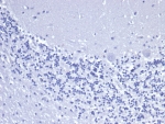 KRT8 Antibody Human Brain Negative Control IHC. Immunohistochemical staining of FFPE human brain tissue using recombinant KRT8 Antibody (clone rKRT8/6471) under negative control conditions demonstrates an absence of specific HRP-DAB staining, with only hematoxylin-counterstained nuclei visible throughout the tissue section. The lack of detectable signal confirms minimal nonspecific background staining and supports the specificity of the immunohistochemical procedure. Cytokeratin 8 (KRT8/CK8) is an epithelial intermediate filament protein that is not expected to be broadly expressed within normal brain parenchyma. Antibody incubation was performed in PBS for 30 minutes at room temperature. HIER: boil tissue sections in pH 9 10 mM Tris with 1 mM EDTA for 20 minutes and allow to cool before testing.
