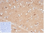 Recombinant AKR1B1 Antibody Brain Immunohistochemistry. IHC staining of FFPE human brain tissue with recombinant AKR1B1 antibody (clone AKR1B1/7009R) at 2ug/ml in PBS for 30 min RT. Negative control inset: PBS used instead of primary antibody to control for secondary Ab binding. HIER: boil tissue sections in pH 9 10mM Tris with 1mM EDTA for 20 min and allow to cool before testing.