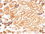 Recombinant AKR1B1 Antibody Kidney Immunohistochemistry. IHC staining of FFPE human kidney tissue with recombinant AKR1B1 antibody (clone AKR1B1/7009R). HIER: boil tissue sections in pH 9 10mM Tris with 1mM EDTA for 20 min and allow to cool before testing.
