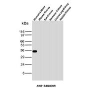 Recombinant AKR1B1 Antibody Cross-Species WB. Western blot analysis of human, mouse, rat, hamster, guinea pig, and rabbit kidney tissue lysates using recombinant AKR1B1 Antibody clone AKR1B1/7009R. A distinct band is detected near approximately 35-40 kDa in human kidney tissue, consistent with the predicted molecular weight of Aldose reductase / AKR1B1, an oxidative stress-associated aldo-keto reductase family enzyme involved in reactive aldehyde detoxification, glucose-responsive signaling, and polyol pathway-associated metabolic regulation. Minimal signal is observed in the additional species tested under these experimental conditions.