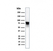 Western blot testing of human PC3 lysate with Moesin antibody (clone SPM562). Predicted molecular weight ~68 kDa but routinely observed at 68-78 kDa.