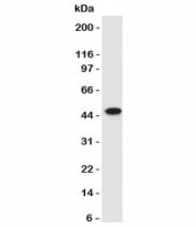 Western blot of HeLa lysate using Cytokeratin 17 antibody clone SPM560.