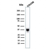 Gp100 Antibody Clone SPM142. Western blot analysis of human COLO-38 melanoma cell lysate using Gp100 Antibody Clone SPM142. Lane 1: human COLO-38 cell lysate. A band is detected at approximately 34-38 kDa, consistent with processed fragments of Premelanosome protein PMEL17, also known as gp100. PMEL is synthesized as an approximately 100 kDa glycosylated precursor that undergoes proteolytic cleavage to generate an approximately 60-64 kDa M-alpha fragment and an approximately 26 kDa M-beta fragment. The M-alpha fragment is further processed into approximately 34-38 kDa and approximately 26 kDa fragments that assemble into the fibrillar matrix of developing melanosomes in melanocytic cells.