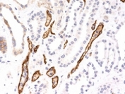 IHC testing of FFPE human kidney transplant with Complement 4d antibody (SPM545). Required HIER: boil tissue sections in 10mM Tris with 1mM EDTA, pH 9.0, for 10-20 min followed by cooling at RT for 20 minutes.