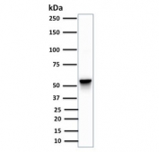 VIM Antibody Clone SPM576 WB. Western blot testing of VIM Antibody Clone SPM576 and human A375 cell lysate. Predicted molecular weight ~58 kDa.
