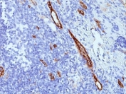 von Willebrand Factor Antibody / Endothelial Secretion Marker Antibody. Immunohistochemistry analysis of human tonsil tissue shows HRP-DAB brown staining of endothelial cells lining vascular channels within lymphoid tissue. The staining highlights vessel-associated endothelium with both luminal and cytoplasmic signal, consistent with VWF localization in storage granules and its release along the vascular surface. This pattern reflects endothelial secretion activity, with signal distribution indicating intracellular storage and extracellular deposition along vessel linings. Clone SPM577 enables visualization of vascular structures together with secretion-associated VWF localization.