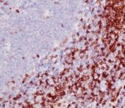 CD5 Antibody for IHC. Immunohistochemistry analysis of CD5 antibody staining in FFPE human tonsil tissue using a co-signaling receptor modulator antibody, clone SPM546. Strong membranous staining is observed in interfollicular T lymphocytes with dense labeling of T cell zones surrounding germinal centers, while follicular B cell areas remain largely negative. The staining pattern highlights normal tonsillar architecture and reflects the role of CD5 in modulating co-signaling pathways that regulate lymphocyte activation and receptor signaling integration.