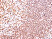 IHC analysis of formalin-fixed, paraffin-embedded human tonsil stained with anti-CD74 antibody (clone SPM523).
