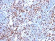 CD8A Antibody Human Lymph Node IHC. Immunohistochemistry analysis of CD8 alpha (CD8A) in FFPE human lymph node tissue shows strong membranous staining of cytotoxic T lymphocytes distributed throughout lymphoid regions, consistent with CD8A expression as an immune profiling marker and supporting identification of CD8-positive T cell populations within a complex immune microenvironment. Heat-induced epitope retrieval was performed in pH 9 10 mM Tris with 1 mM EDTA for 20 minutes followed by cooling prior to antibody incubation.