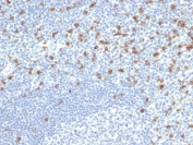 CD8A Antibody Human Tonsil Tissue IHC. Immunohistochemistry analysis of CD8 alpha (CD8A) in FFPE human tonsil tissue shows membranous staining of cytotoxic T lymphocytes distributed within lymphoid regions, consistent with CD8A expression as an immune profiling marker and supporting identification and assessment of CD8-positive T cell populations within a complex immune microenvironment. Heat-induced epitope retrieval was performed in pH 9 10 mM Tris with 1 mM EDTA for 20 minutes followed by cooling prior to antibody incubation.