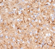 SYP Antibody Recombinant Mouse MAb Clone rSYP/6856. Immunohistochemistry analysis of FFPE human brain tissue shows widespread cytoplasmic HRP-DAB brown staining within neuronal cells and neuropil, consistent with Synaptophysin (SYP) localization in presynaptic vesicle membranes. The staining pattern highlights dense synaptic vesicle populations throughout neuronal processes and synapse-rich regions of brain tissue. Hematoxylin counterstain marks nuclei in blue. The recombinant mouse monoclonal SYP antibody clone rSYP/6856 was used to detect synaptic vesicle protein expression in human brain tissue. Heat-induced epitope retrieval was performed by boiling tissue sections in pH 9 10mM Tris with 1mM EDTA for 20 minutes followed by cooling prior to staining.
