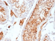 INHA Antibody Rabbit Monoclonal (clone INHA/6598R) IHC staining of human testis. Immunohistochemistry analysis of FFPE human testis tissue using INHA Antibody Rabbit Monoclonal (clone INHA/6598R) shows HRP-DAB brown cytoplasmic staining in testicular cells within seminiferous tubules, consistent with Inhibin subunit alpha (INHA) expression in Sertoli cell populations, while surrounding stromal elements show minimal staining. HIER: tissue sections were boiled in pH 9 10mM Tris with 1mM EDTA for 20 minutes and allowed to cool before testing.