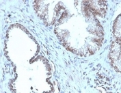 Prostein Antibody for IHC. Immunohistochemistry analysis of Prostein / SLC45A3 antibody staining in FFPE human prostate tissue using clone SLC45A3/4965R. Strong cytoplasmic and perinuclear staining is observed in prostate glandular epithelial cells outlining luminal structures, with a punctate distribution consistent with Golgi-associated localization of Prostein, while surrounding stromal cells remain negative. The staining highlights epithelial polarity and secretory compartment organization within prostate glands, supporting the role of SLC45A3 as a Golgi-associated protein in secretory epithelial cells. Heat-induced epitope retrieval was performed in pH 9 Tris-EDTA buffer for 20 minutes followed by cooling prior to antibody incubation.